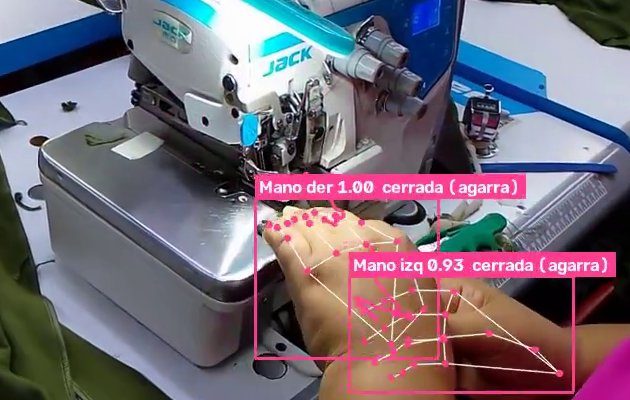 Video de una operación con las manos detectadas por la IA